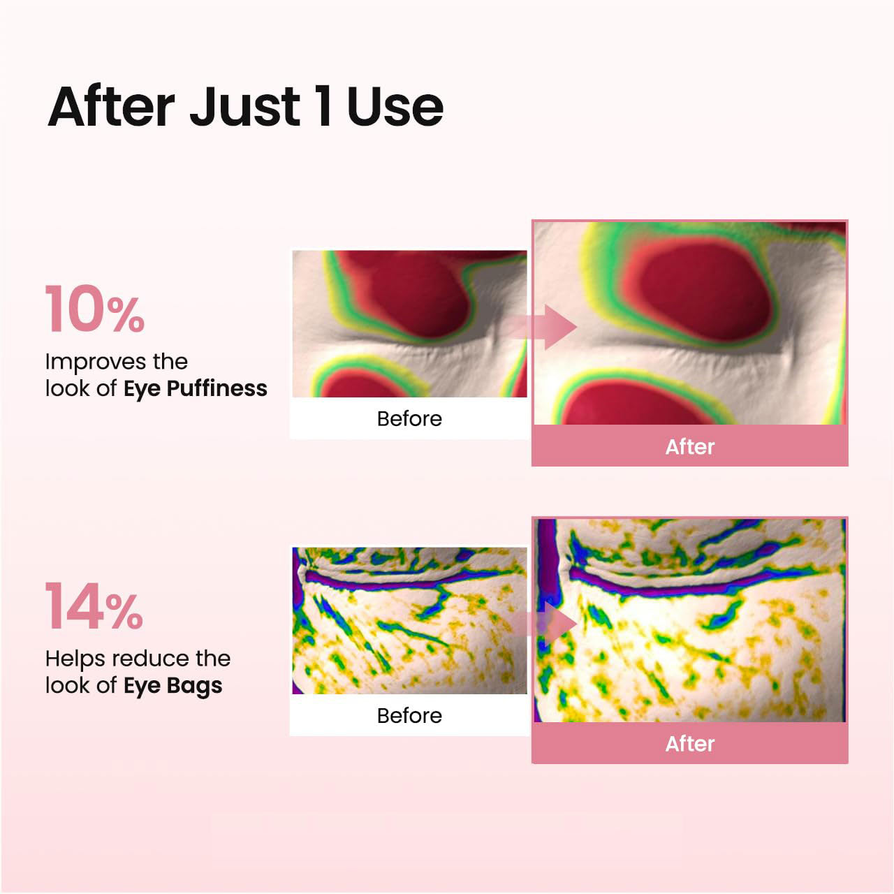 Collagen Peptide Eye & Smile Line Patches – Anti-Wrinkle Korean Skincare, 60 Count